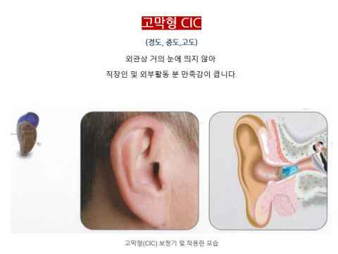 경도난청이란?