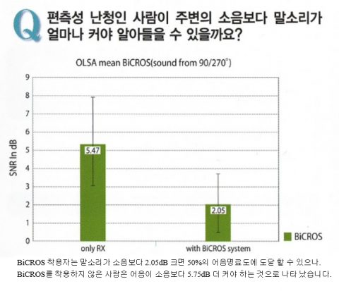 편측성난청이란?