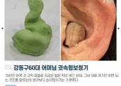 귓속형 보청기끼면 아프시다구요? 강동구 60대 어머님 통증없이 완벽착용 후기